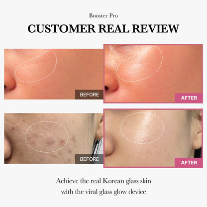 [6-in-1 Beauty Device] AGE-R Booster Pro