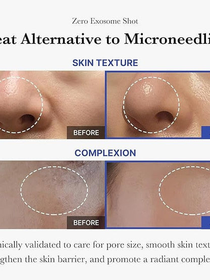 Medicube One Day Exosome Shot Pore Ampoule 2000