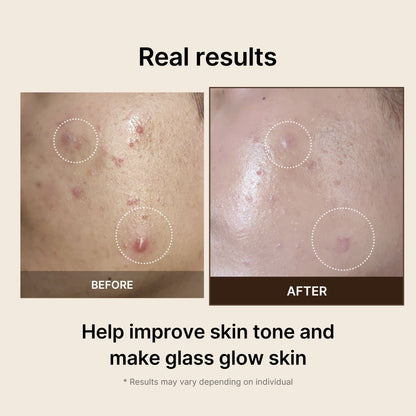 [No.1 Dark Spot Brightening Toner Pad] Deep Vita C Pad